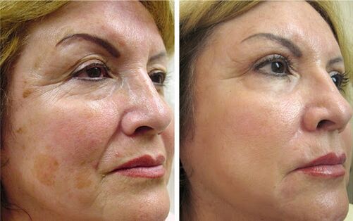After using Canabilab, Anna from Wroclaw is effective in smoothing wrinkles and tightening facial contours