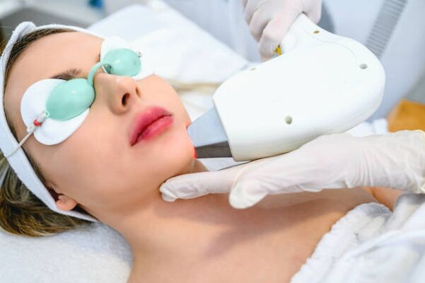 Laser facial rejuvenation surgery