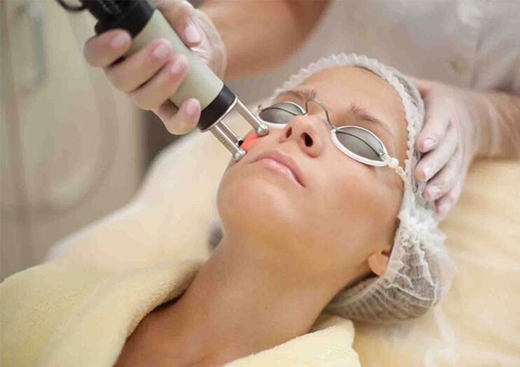 eye area laser skin rejuvenation